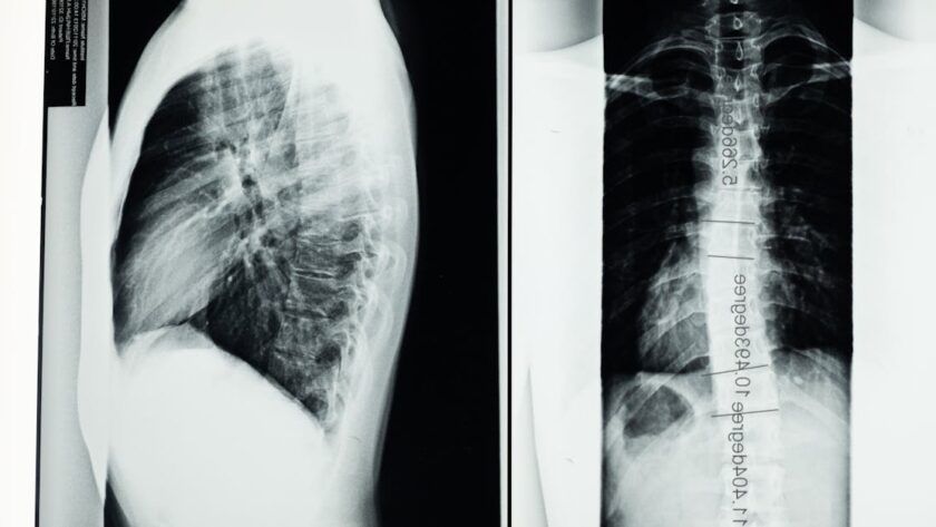 découvrez comment tildren aide à traiter les maladies osseuses chez les chevaux, améliorant leur santé et leur mobilité grâce à une action ciblée.